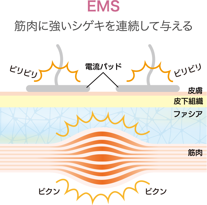 EMS 筋肉に強いシゲキを連続して与える