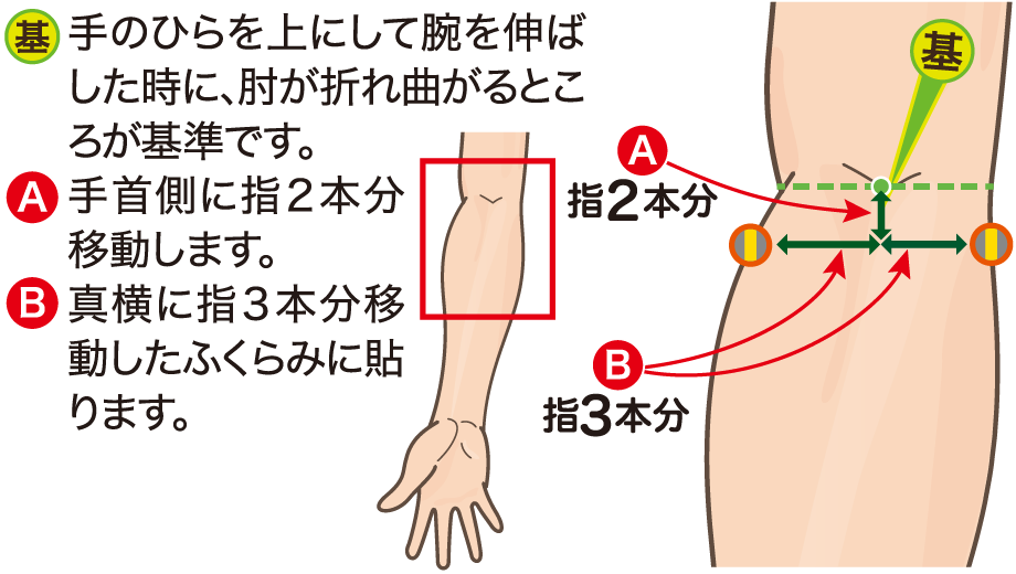 肘に貼る位置の図